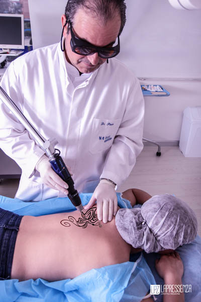 laser picosure
