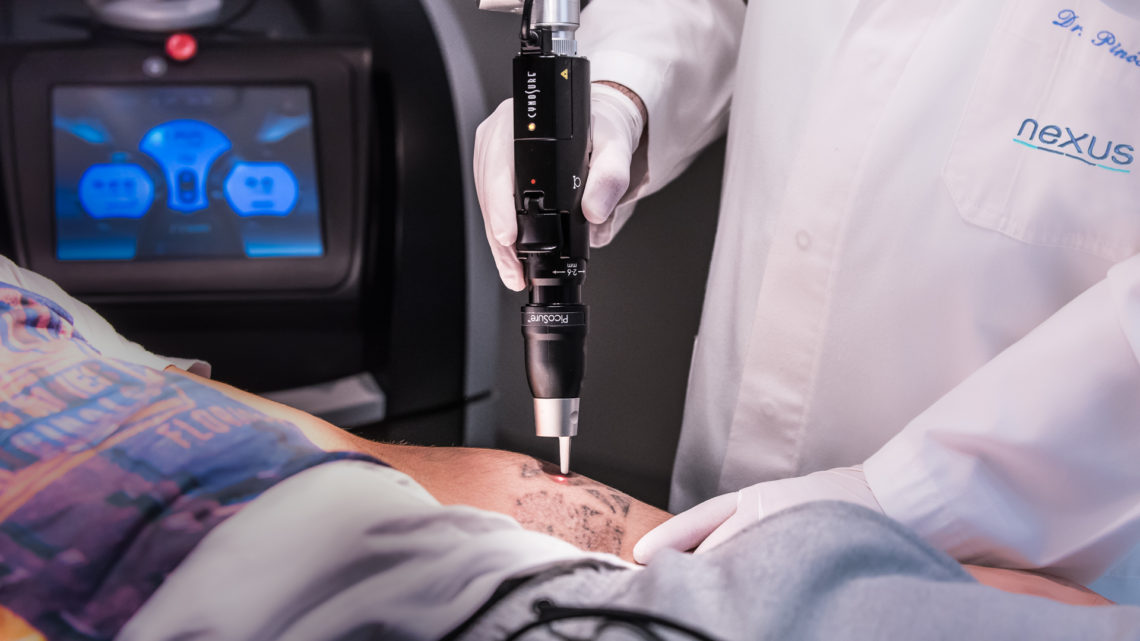 laser picosure