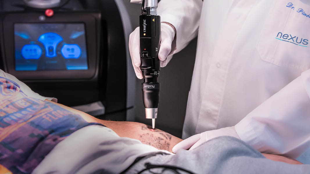 laser picosure