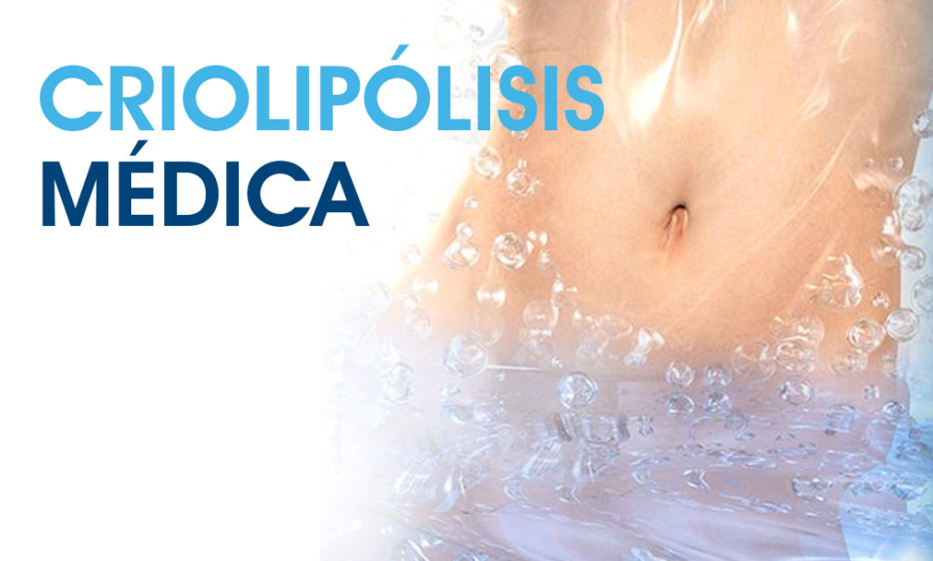criolipolisis medica