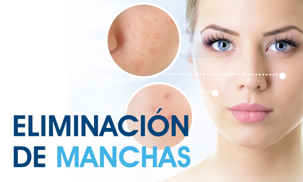 eliminacion manchas