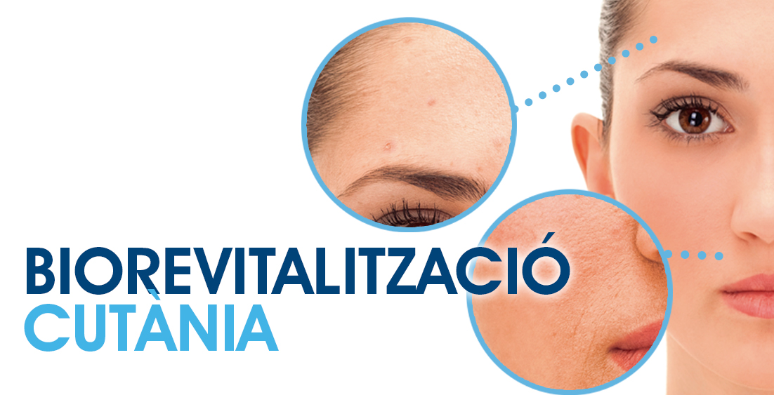 biorevitalització cutania