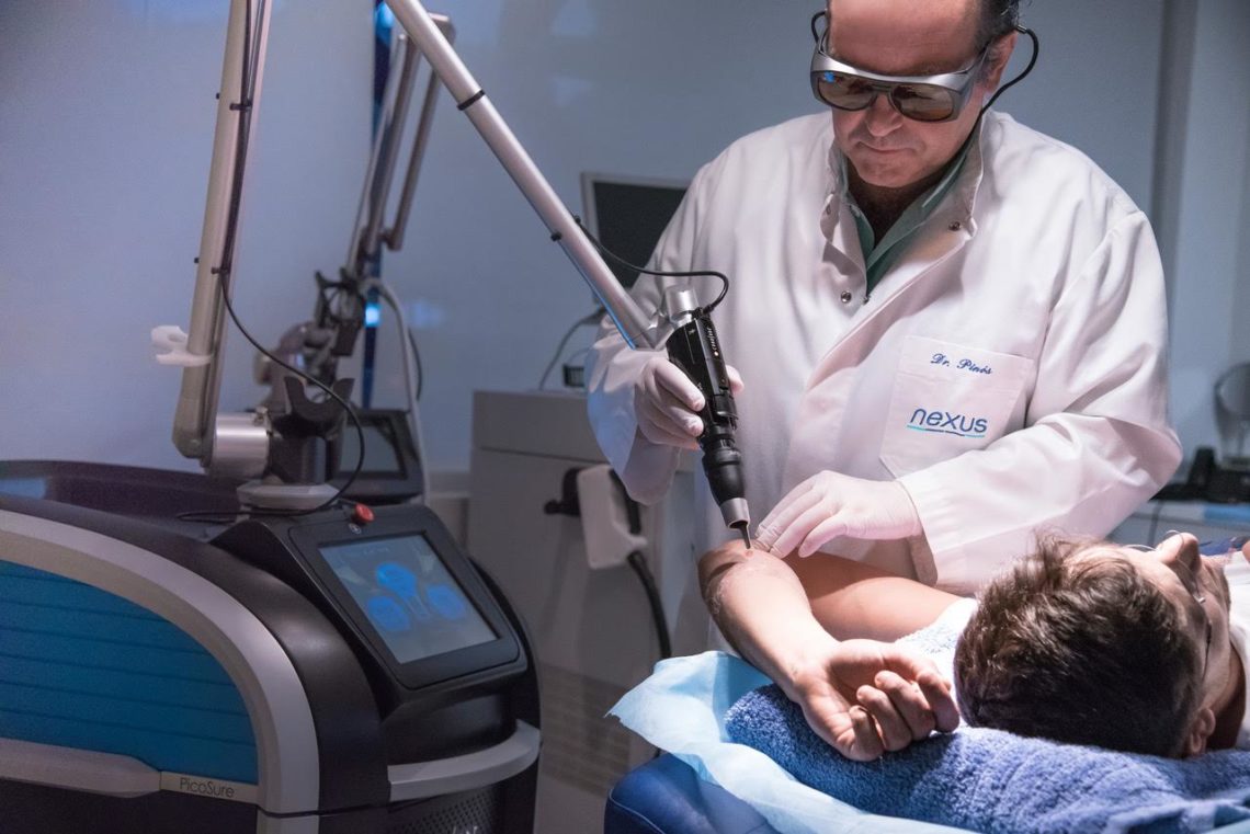 eliminació tatuatges picosure