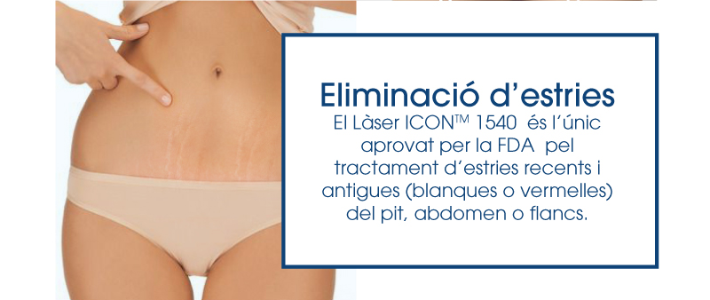 eliminació d'estries