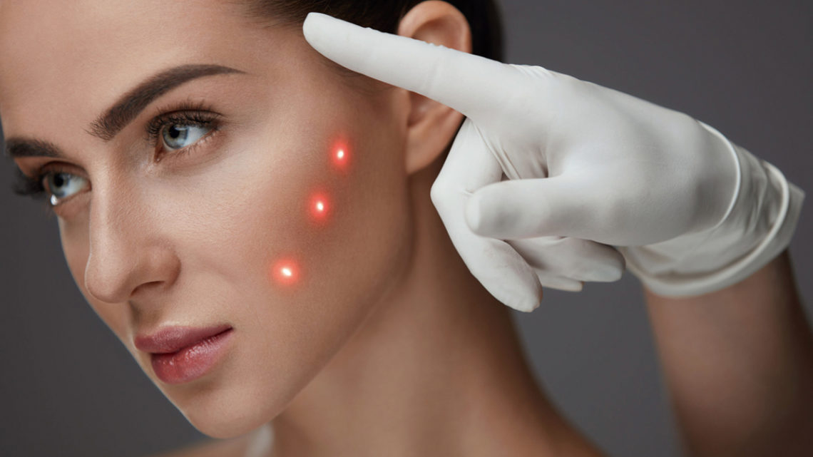 Bioremodelació facial