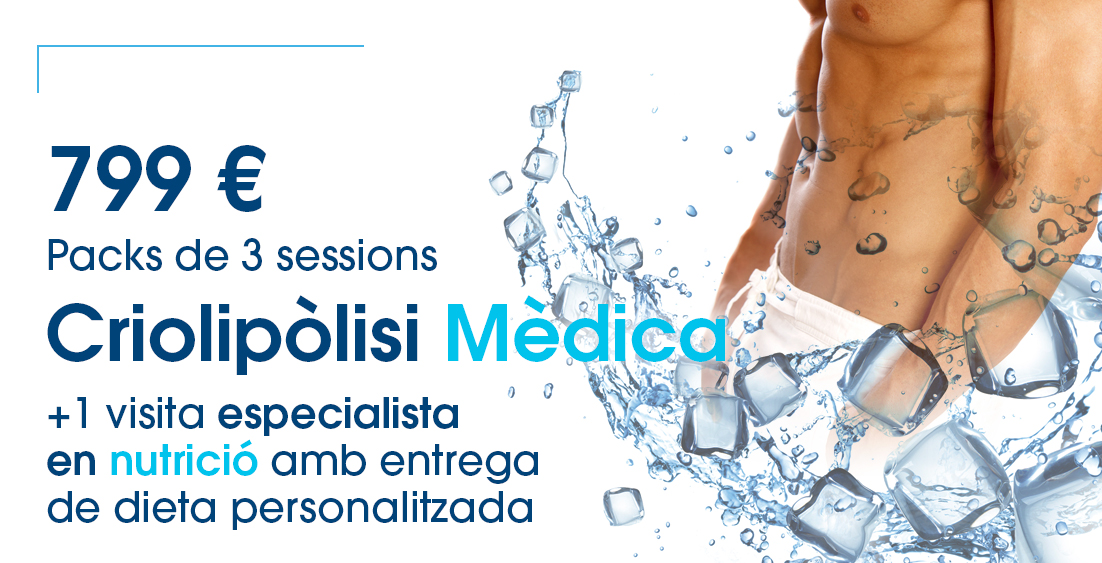criolipolisis