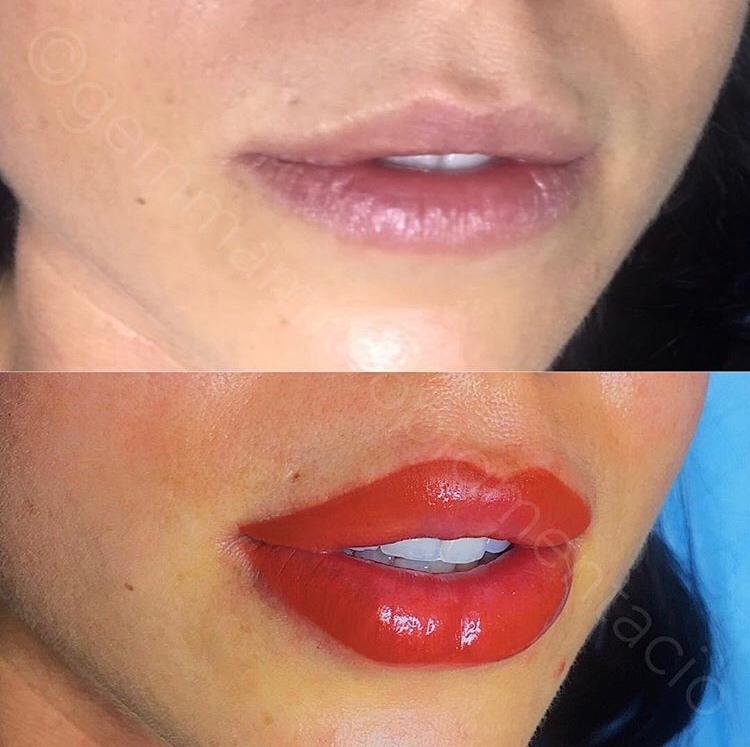micropigmentacio labial