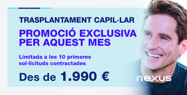Trasplantament capil·lar
