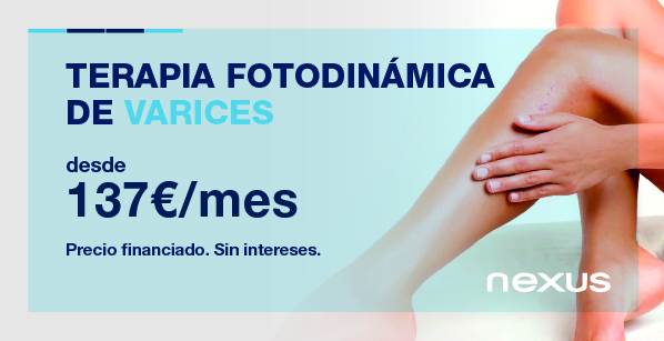 promoción varices