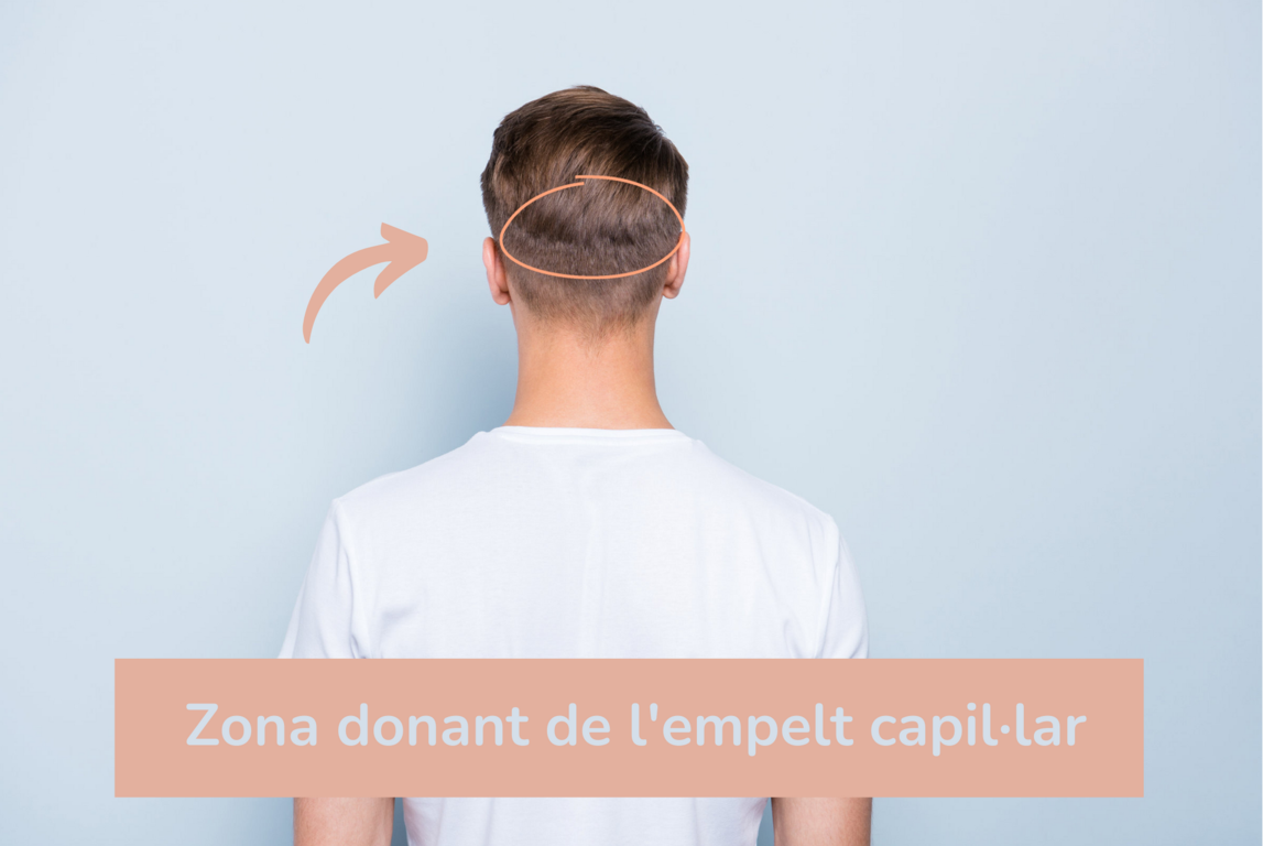 Zona empelt capil·lar