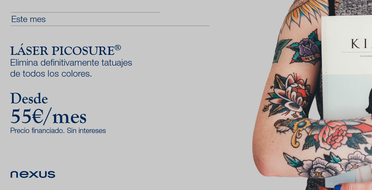 eliminación tatuajes nexus