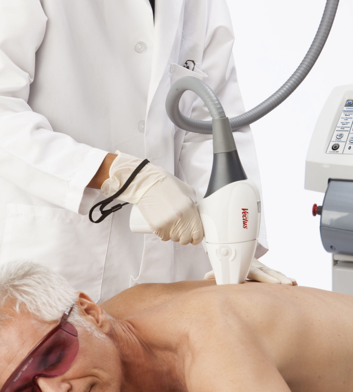 Depilació laser VECTUS