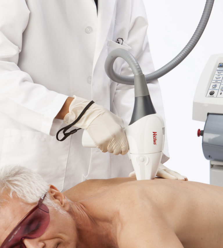 Depilació laser VECTUS