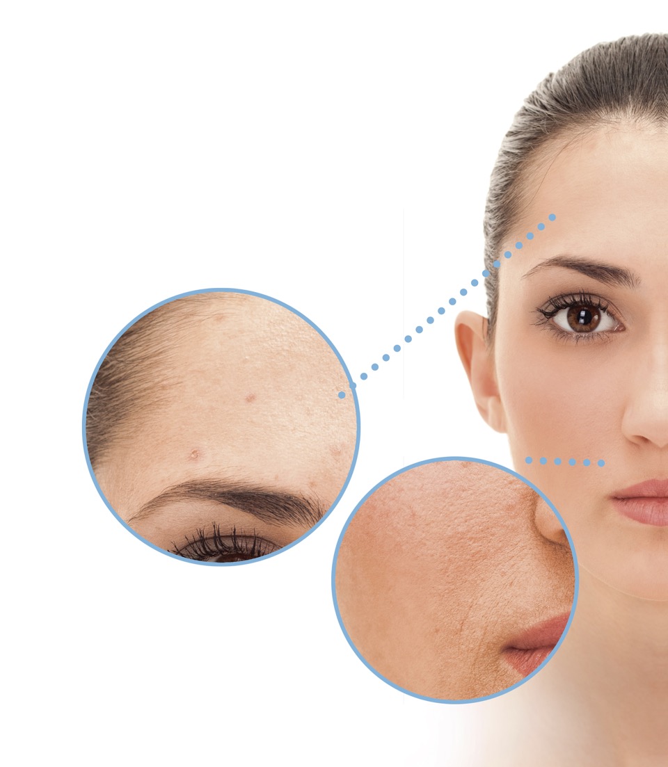 bioestimulacio dona