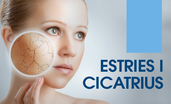 estries