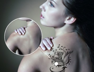 eliminació tatuatges picosure