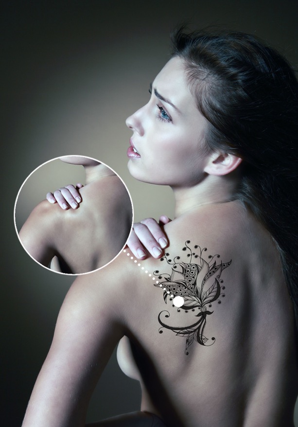 eliminació tatuatges picosure
