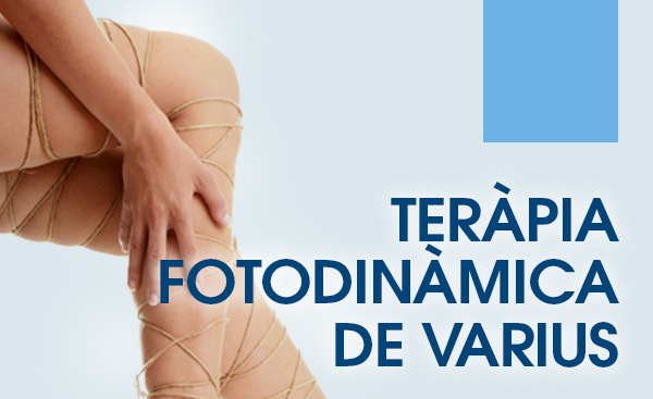 Terapia fotodinàmica de varius Terapia fotodinàmica de varius